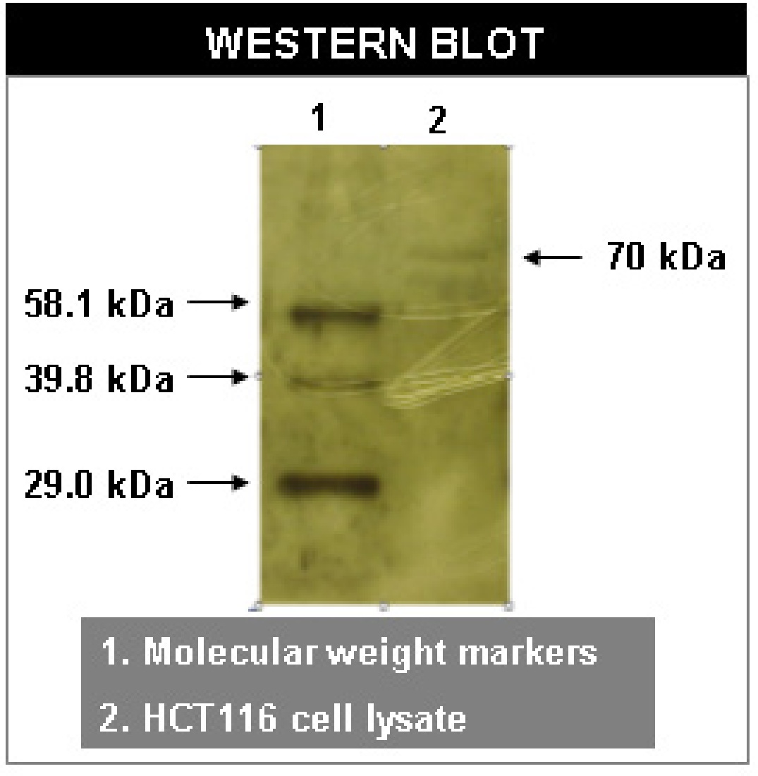 Western blot using RYK antibody (Cat. No. X2072M) on HCT116 cell lysates.
